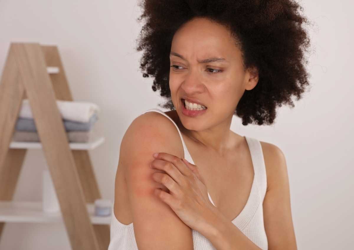 What is eczema? What causes eczema? What are the symptoms of eczema?